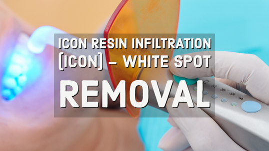 ICON Resin Infiltration Removal machine