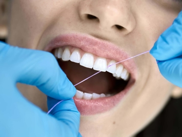 Dental Cleaning & Exams