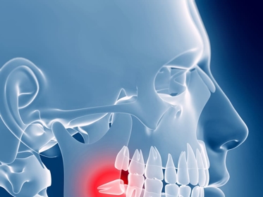 Emergency Tooth Extraction